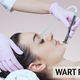 Warts Removal Dubai